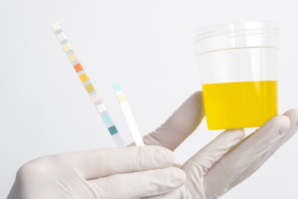 Advantages of At-Home Urine Tests