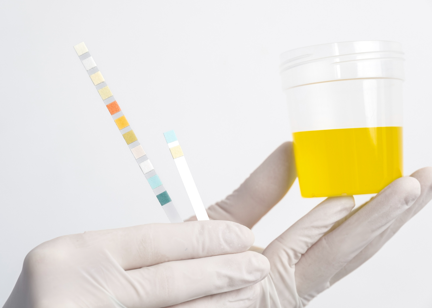 Advantages of At-Home Urine Tests