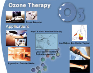Hydrogen Water Generator vs. Ozone Therapy