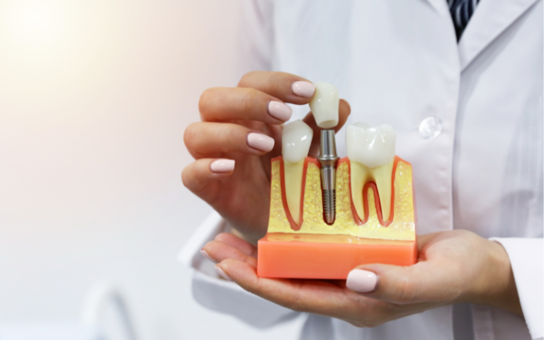 How Dental Implants Can Restore Your Confidence and Smile